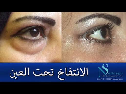 پاك كريم و سيروم الحلزون ✨✨✨